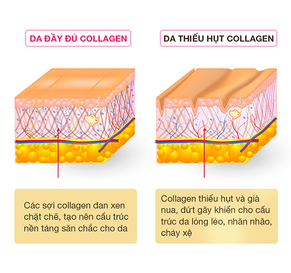 Kami Collagen1